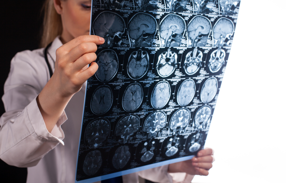 Professional young doctor woman in white labcoat holding mri of human brain and looking at it